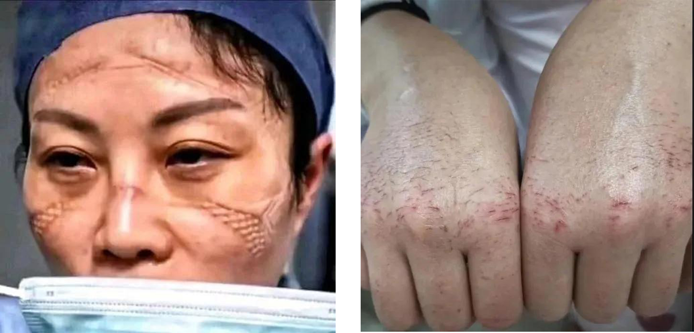 攜手戰(zhàn)“疫”｜超暖心，增力集團(tuán)董事長(zhǎng)李增力向清江浦區(qū)愛(ài)心捐贈(zèng)22萬(wàn)元(圖2)